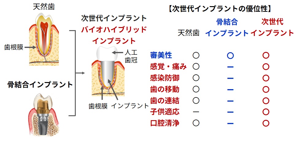 バイオハイブリッドインプラント 図1