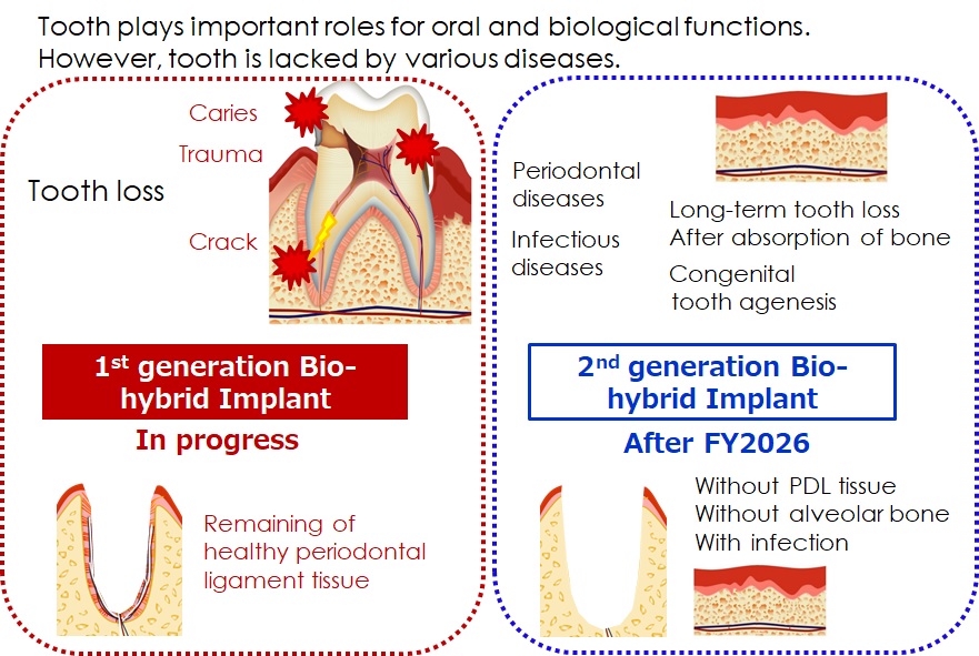 バイオハイブリッドインプラント 図3