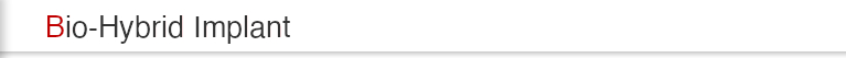 バイオハイブリッドインプラント