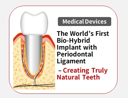 バイオハイブリッドインプラント