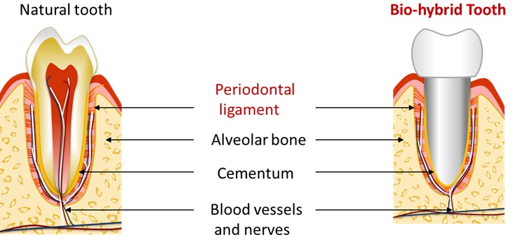 Figure 2: Bio-Hybrid Tooth