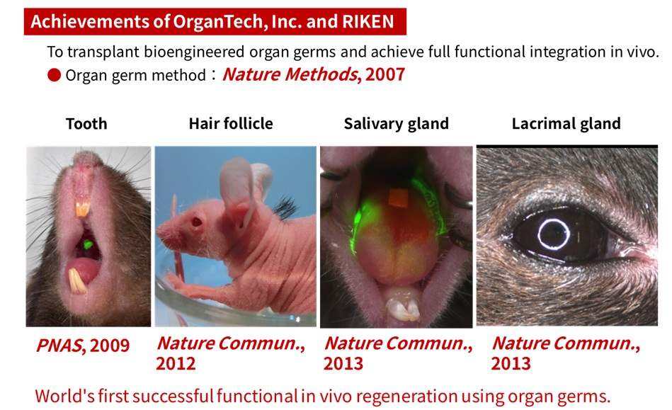 Figure 4: Development toward organ regenerative medicine