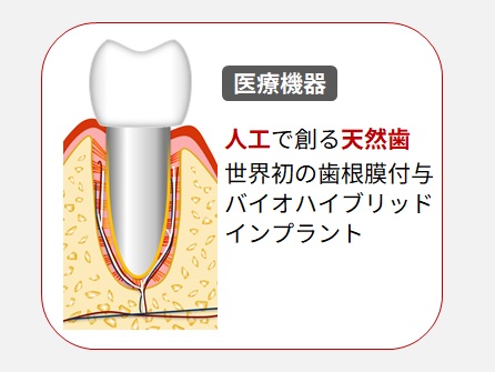 バイオハイブリッドインプラント