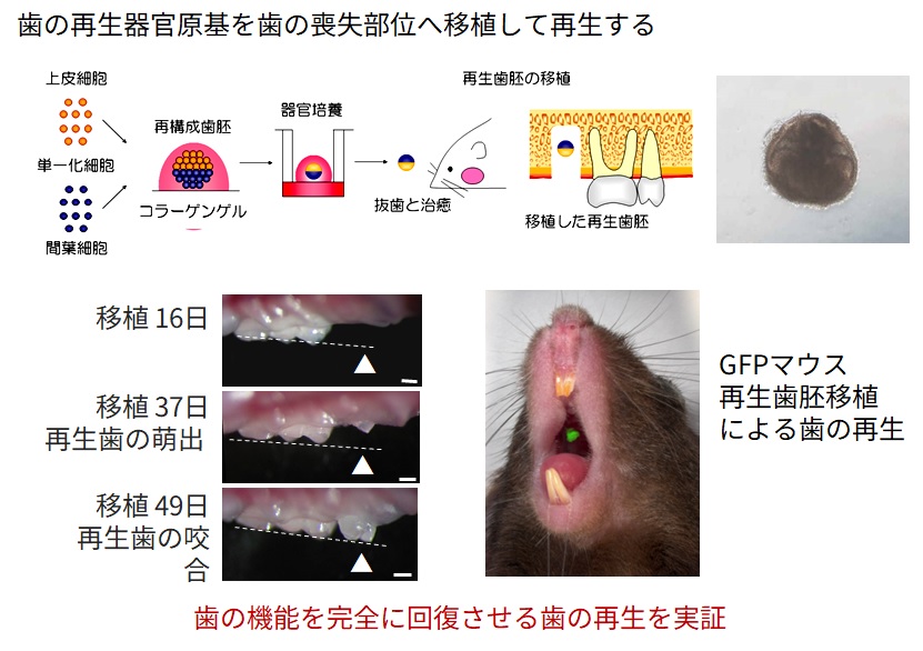 器官原基法による歯の再生