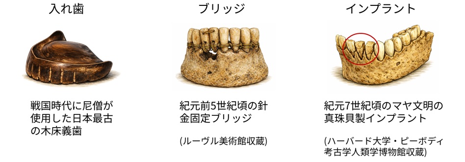 図2 歯科治療の歴史
